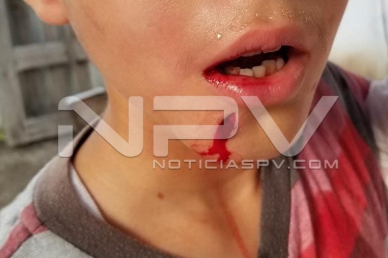 Seguridad Bahia de Banderas ·1445